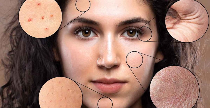 Natural Radiance with Ayurveda