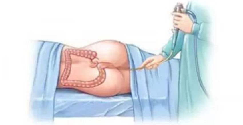 Ayurvedic Enema (Basti) – The Ultimate Detox for Body and Mind