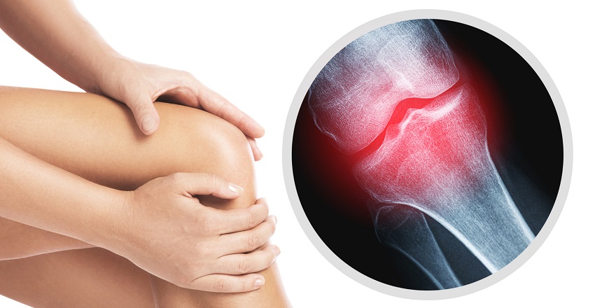 Why Knee Pain and Cervical Issues Worsen in the Rainy Season – Ayurvedic Perspective, Precautions, and Treatments